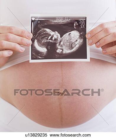 Stock Photography - Pregnant woman with ultrasonography scan. Fotosearch