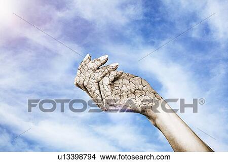 Close up of cracked, dry hand View Large Photo Image Picture - Close up of cracked, dry hand. Fotosearch
