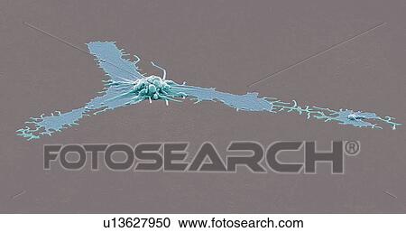 Stock Image - Activated platelet. Coloured scanning electron micrograph (SEM) of an activated platelet, or thrombocyte, from peripheral blood. Magnification: x2, 500 when printed at 10 centimetres wide.. Fotosearch