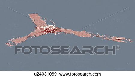 Stock Photo - Activated platelet. Coloured scanning electron micrograph (SEM) of an activated platelet, or thrombocyte, from peripheral blood. Magnification: x2, 500 when printed at 10 centimetres wide.. Fotosearch