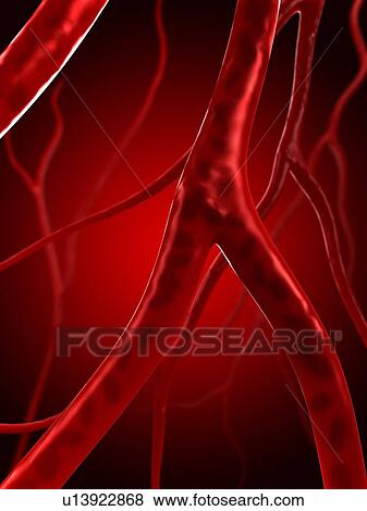 Stock Photo - Arteries, computer artwork.. Fotosearch