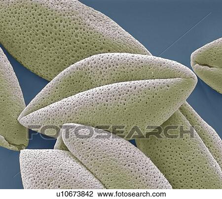 Stock Image - Asparagus (Asparagus officinalis) pollen grains, coloured scanning electron micrograph (SEM). Magnification: x2000 when printed at 10 centimetres wide.. Fotosearch