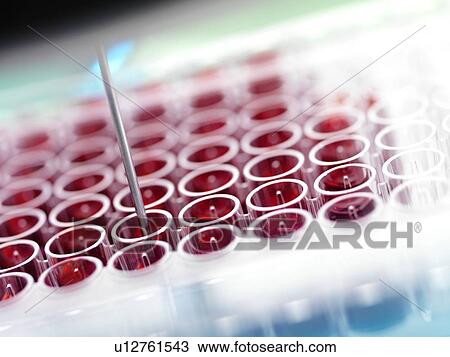 Stock Image - Automated blood screening.. Fotosearch
