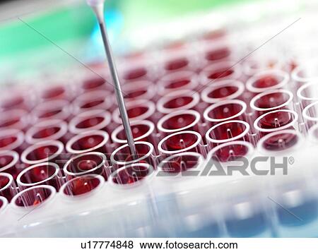 Automated blood screening. View Large Photo Image Stock Photo - Automated blood screening.. Fotosearch