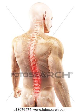 Picture - Back pain, conceptual computer artwork.. Fotosearch