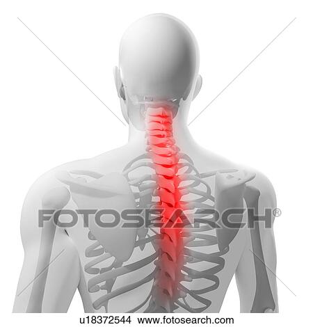 Picture - Back pain, conceptual computer artwork.. Fotosearch