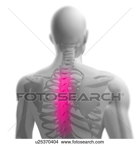 Picture - Back pain, conceptual computer artwork.. Fotosearch
