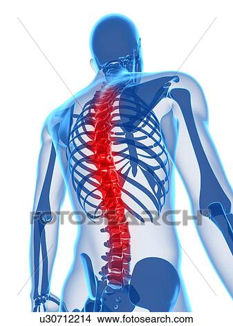 Back pain, conceptual computer artwork. View Large Photo Image Picture - Back pain, conceptual computer artwork.. Fotosearch