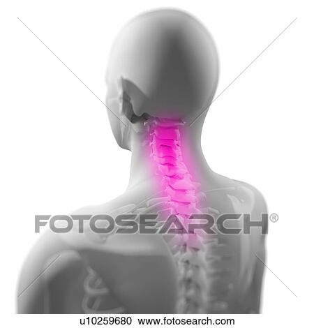 Stock Image - Back pain, conceptual computer artwork.. Fotosearch