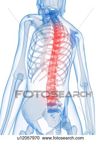 Back pain, conceptual computer artwork. View Large Photo Image Stock Image - Back pain, conceptual computer artwork.. Fotosearch