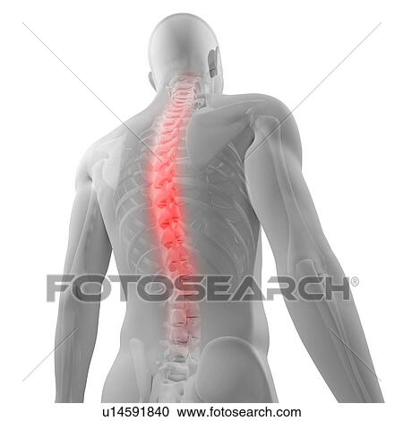 Stock Image - Back pain, conceptual computer artwork.. Fotosearch