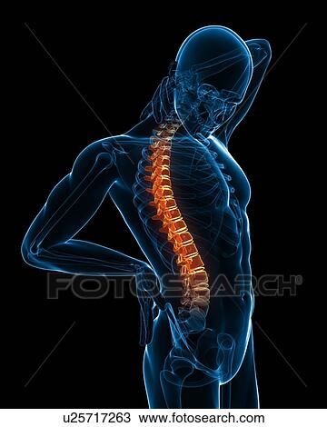 Back pain, conceptual computer artwork. View Large Photo Image Stock Image - Back pain, conceptual computer artwork.. Fotosearch