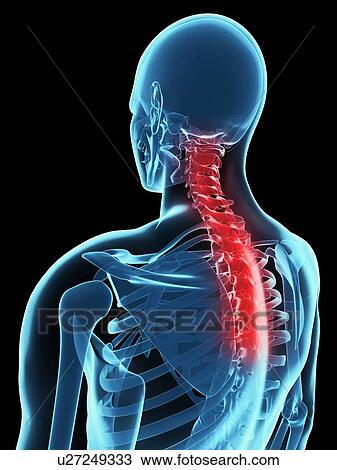Back pain, conceptual computer artwork. View Large Photo Image Stock Image - Back pain, conceptual computer artwork.. Fotosearch