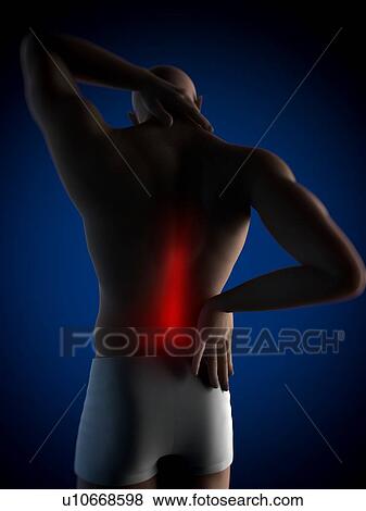 Back pain, conceptual computer artwork. View Large Photo Image Stock Photo - Back pain, conceptual computer artwork.. Fotosearch