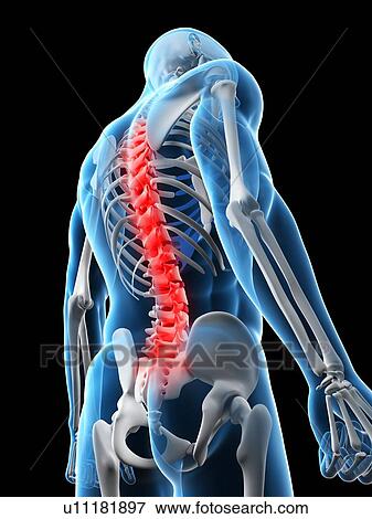 Back pain, conceptual computer artwork. View Large Photo Image Stock Photo - Back pain, conceptual computer artwork.. Fotosearch