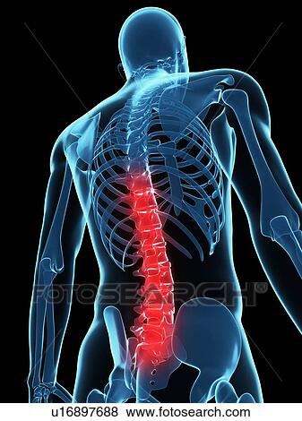 Back pain, conceptual computer artwork. View Large Photo Image Stock Photo - Back pain, conceptual computer artwork.. Fotosearch