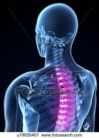 Back pain, conceptual computer artwork. View Large Photo Image Stock Photo - Back pain, conceptual computer artwork.. Fotosearch