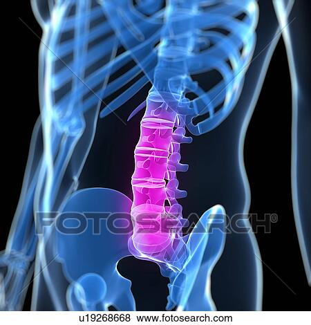 Back pain, conceptual computer artwork. View Large Photo Image Stock Photo - Back pain, conceptual computer artwork.. Fotosearch