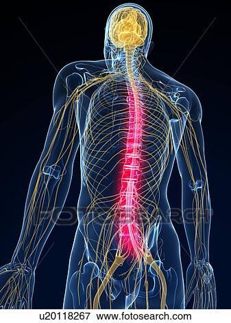 Stock Photo - Back pain, conceptual computer artwork.. Fotosearch