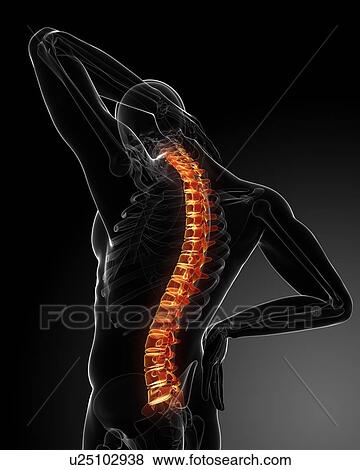 Stock Photo - Back pain, conceptual computer artwork.. Fotosearch