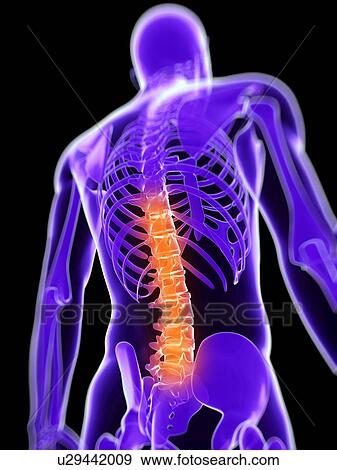 Back pain, conceptual computer artwork. View Large Photo Image Stock Photo - Back pain, conceptual computer artwork.. Fotosearch