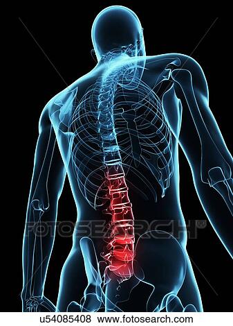 Back pain, conceptual computer artwork. View Large Photo Image Stock Photo - Back pain, conceptual computer artwork.. Fotosearch