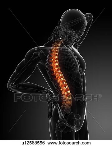 Stock Photograph - Back pain, conceptual computer artwork.. Fotosearch