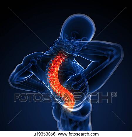 Back pain, conceptual computer artwork. View Large Photo Image Stock Photograph - Back pain, conceptual computer artwork.. Fotosearch