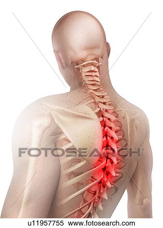 Back pain, conceptual computer artwork. View Large Photo Image Stock Photography - Back pain, conceptual computer artwork.. Fotosearch