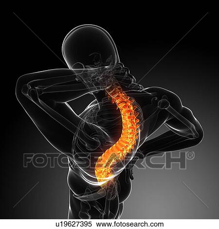 Back pain, conceptual computer artwork. View Large Photo Image Stock Photography - Back pain, conceptual computer artwork.. Fotosearch