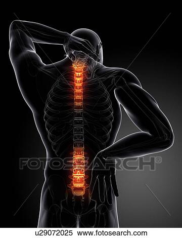 Back pain, conceptual computer artwork. View Large Photo Image Stock Photography - Back pain, conceptual computer artwork.. Fotosearch
