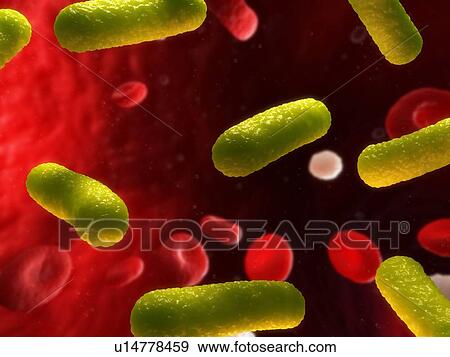 Stock Photo - Bacterial infection. Computer artwork of bacteria (yellow) in the blood stream.. Fotosearch