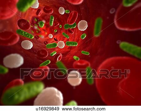 Bacterial infection. Computer artwork of bacteria (green) in the blood stream. View Large Photo Image Stock Photo - Bacterial infection. Computer artwork of bacteria (green) in the blood stream.. Fotosearch