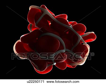 Stock Image - Blood clot. Computer artwork of red blood cells trapped in a fibrin protein mesh.. Fotosearch