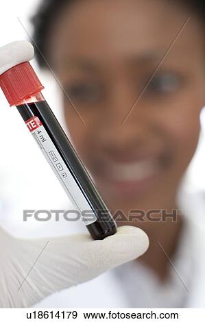 Blood sample. View Large Photo Image Stock Photo - Blood sample.. Fotosearch