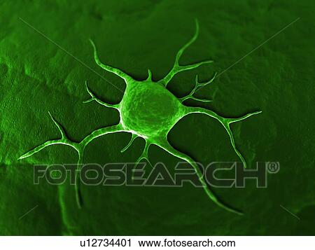 Cancer cell, conceptual computer artwork. The uneven surface and cytoplasmic projections are characteristic of cancer cells. View Large Photo Image Stock Image - Cancer cell, conceptual computer artwork. The uneven surface and cytoplasmic projections are characteristic of cancer cells.. Fotosearch