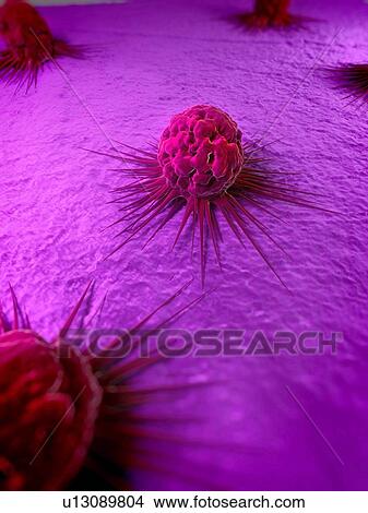 Picture - Cancer cells, computer artwork. The uneven surface and cytoplasmic projections are characteristic of cancer cells.. Fotosearch