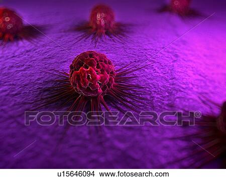 Picture - Cancer cells, computer artwork. The uneven surface and cytoplasmic projections are characteristic of cancer cells.. Fotosearch
