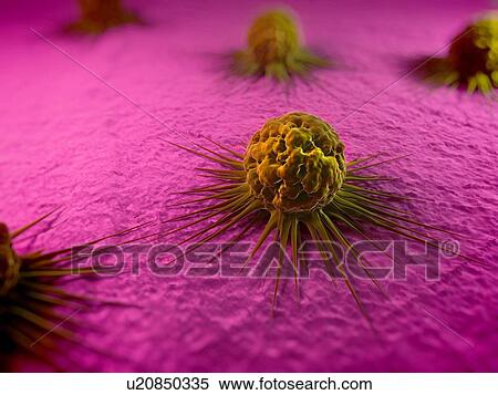 Stock Photography - Cancer cells, computer artwork. The uneven surface and cytoplasmic projections are characteristic of cancer cells.. Fotosearch