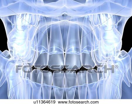 Stock Photo - Close up x-ray view of a closed mouth. This image highlights the teeth in the jaw with no surrounding tissue or muscle.. Fotosearch