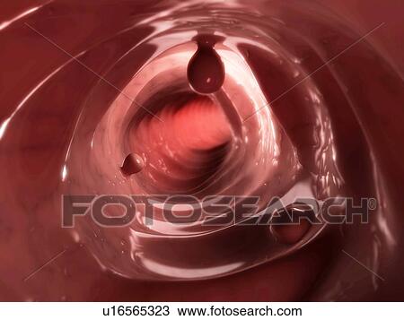 Stock Image - Colon polyps, computer artwork.. Fotosearch
