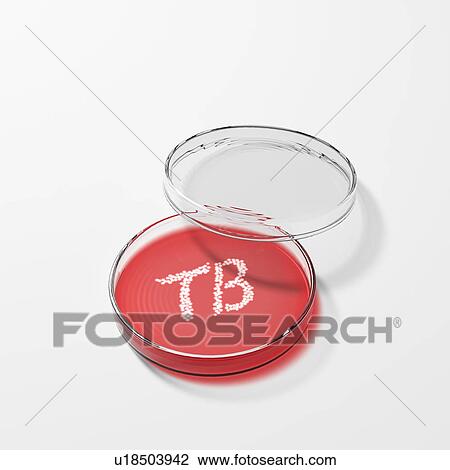Stock Image - Conceptual computer artwork showing Tuberculosis (TB) bacteria cultured in a petri dish. Tuberculosis usually attacks the lungs but can also affect other parts of the body.. Fotosearch