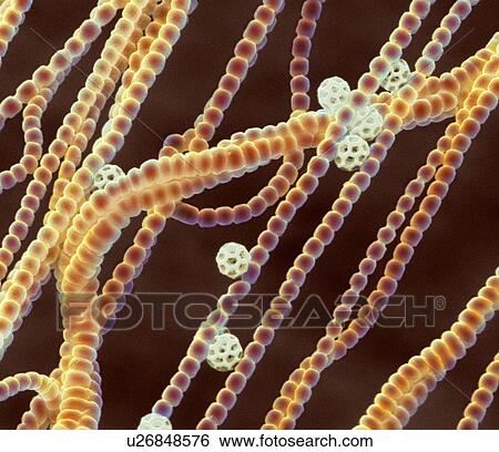 Stock Photograph - Cyanobacteria. Coloured scanning electron micrograph (SEM) of cyanobacteria (formally known as blue-green algae, brown). Several spores (white) are also seen.. Fotosearch