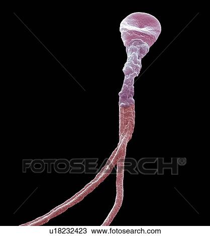 Stock Image - Deformed sperm cell. Coloured scanning electron micrograph (SEM) of a sperm cell with multiple tails. Magnification: x5000 when printed at 10 centimetres wide.. Fotosearch