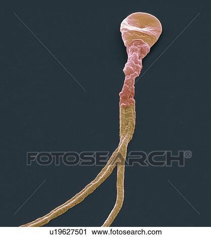 Stock Image - Deformed sperm cell. Coloured scanning electron micrograph (SEM) of a sperm cell with multiple tails. Magnification: x5000 when printed at 10 centimetres wide.. Fotosearch