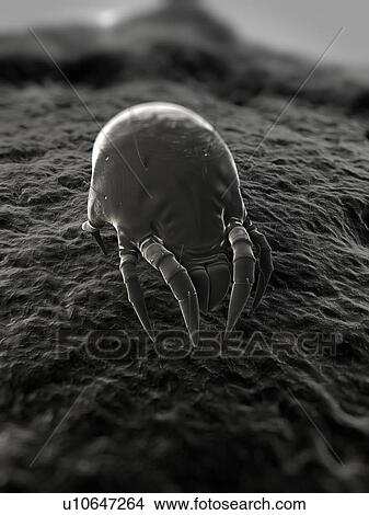 Picture - Dust mite. Computer artwork of a house dust mite (Dermatophagoides pteronyssinus).. Fotosearch