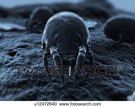 Stock Image - Dust mite. Computer artwork of a house dust mite (Dermatophagoides pteronyssinus).. Fotosearch