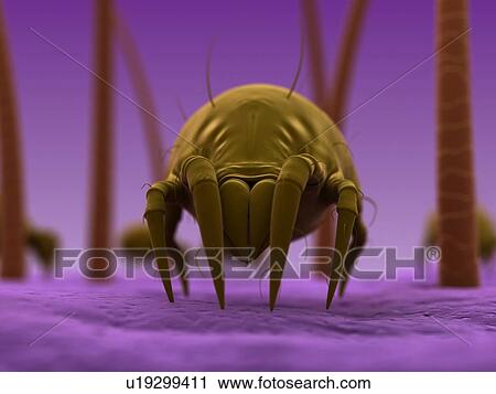 Stock Image - Dust mite. Computer artwork of a house dust mite (Dermatophagoides pteronyssinus) on human skin.. Fotosearch