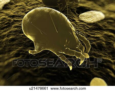 Stock Image - Dust mite. Computer artwork of a house dust mite (Dermatophagoides pteronyssinus).. Fotosearch