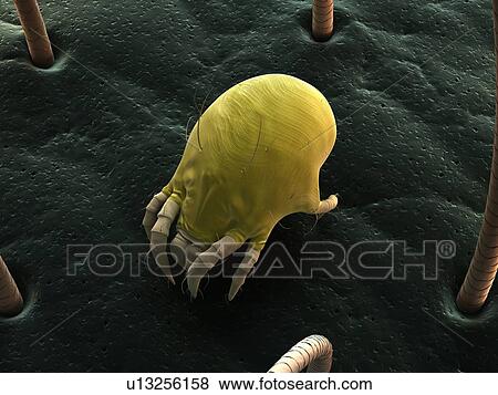 Dust mite. Computer artwork of a house dust mite (Dermatophagoides pteronyssinus) on human skin. View Large Photo Image Stock Photo - Dust mite. Computer artwork of a house dust mite (Dermatophagoides pteronyssinus) on human skin.. Fotosearch